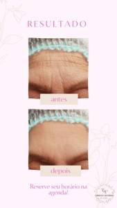 Estetica Facial E Corporal