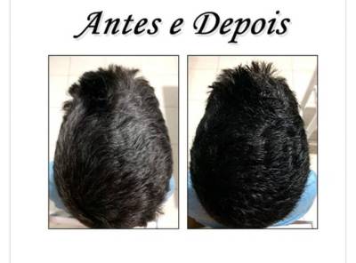 Kit Com 3 Sachs Dexe Black Hair Shampoo