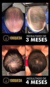 100queda
