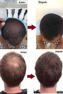 Toppik Hair Maquiagem Capilar Queratina Em P
