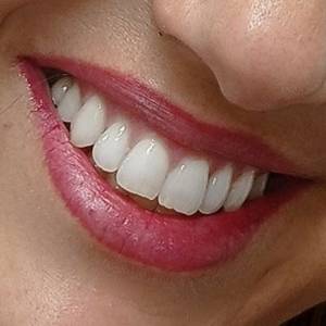 Promoo Micropigmentao