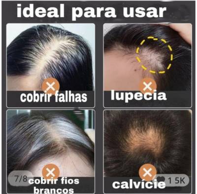 Portese Capilar Feminino