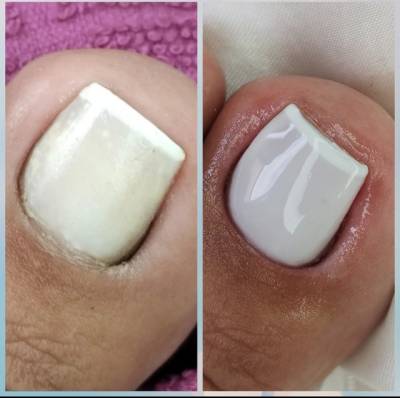 Manicure E Pedicure