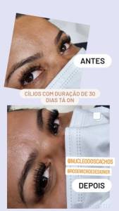 Clios Mtodo Capping