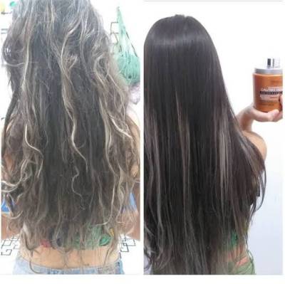 Cauterizao Capilar