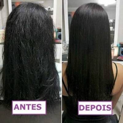 Cauterizao