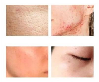 The Ordinary Glycolic Acid 7% Toning Solution