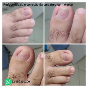 Podologia