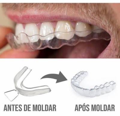 Moldeira Anti-bruxismo