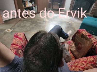 Ervik No Funciona