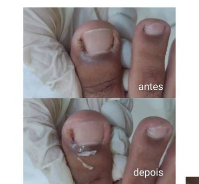 Podologa Ane Dantas