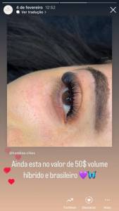 Extensao De Clios