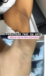 Promoo Desodorante Clareador Rosa Selvagem