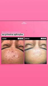Promoo Srum Clareador Rosa Selvagem