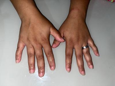 Unhas De Fibra De Vidro