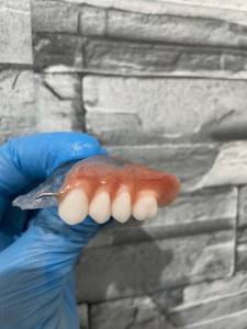 Prtese Dentria