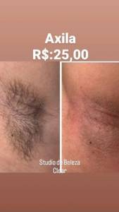Axila  Promoo