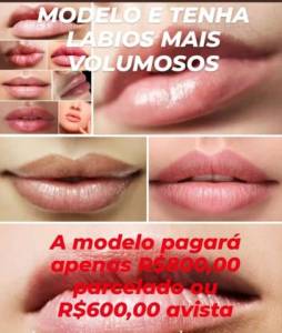 Precisa Modelos Preenchimento Labial