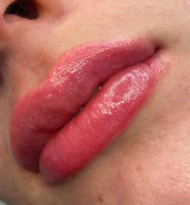 Micropigmentao Labial Ou Neutralizao Labial