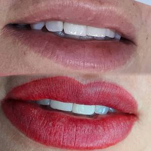 Micro Labial