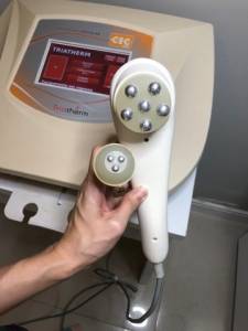 Radiofrequncia Esttica