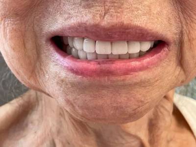 Prtese Dentria