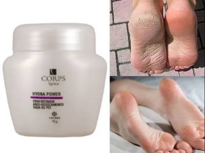 Creme Anti Ressecamento - Creme Os Ps - Rachadura