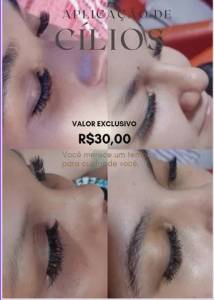 Aplicao De Clios