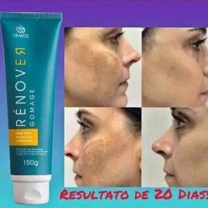 Tratamento Manchas Escuras Na Pele