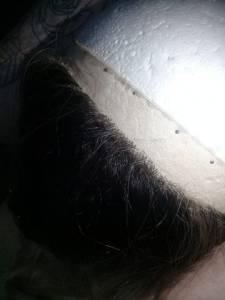 Recupero Sua Lace