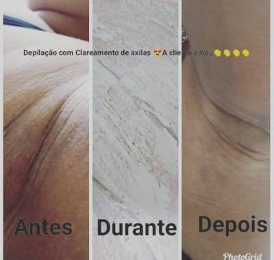 Curso De Depilao, Promoo!!!