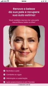 Rosa Amaznica. Chegou Sua Vez De Ter A Pele Dos Sonhos!