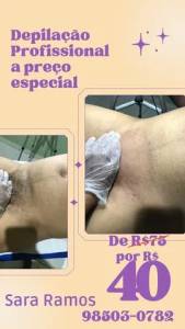 Depilao