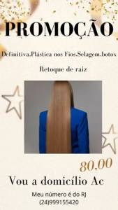 Selagem,seme Definitiva,botox,tratamento Personalizado