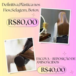 Selagem,seme Definitiva,botox,tratamento Personalizado