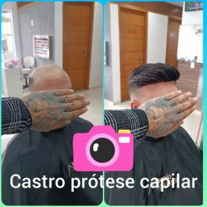 Aplicao De Prtese Capilar